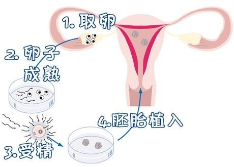 时差培养箱